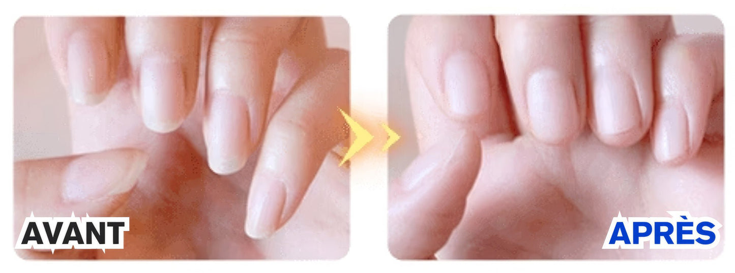 🔥 Coupe - Ongles Électrique 2 en 1 - ProTrim™ - Amour Bébé